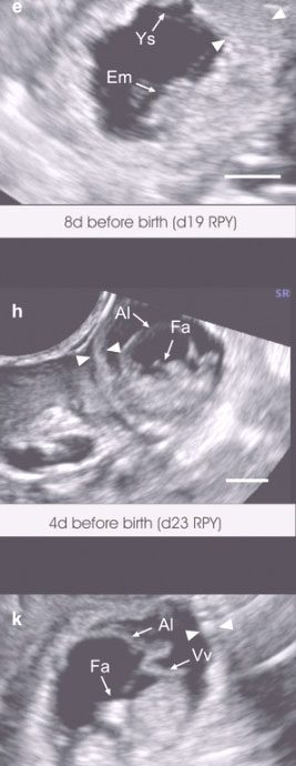 gynaecology